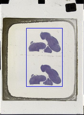 Media type: image; Special Collections 3043   shows specimen_part histological serial section;